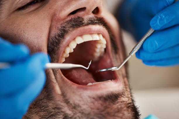 Best 24-Hour Emergency Dentist in Muscatine, IA