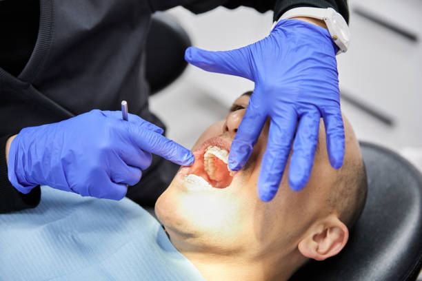 Best Emergency Treatment for Toothache in Muscatine, IA