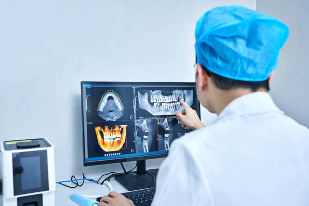 Best Emergency Wisdom Teeth Removal in Muscatine, IA